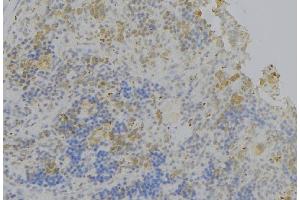 ABIN6278483 at 1/100 staining Human lymph node tissue by IHC-P. (IL4 Receptor 抗体  (N-Term))