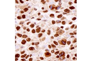 Immunohistochemistry (IHC) image for anti-Heterogeneous Nuclear Ribonucleoprotein K (HNRNPK) (C-Term) antibody (ABIN7448598) (HNRNPK 抗体  (C-Term))