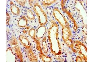 Immunohistochemistry of paraffin-embedded human kidney tissue using ABIN7154587 at dilution of 1:100 (GEM 抗体  (AA 1-150))