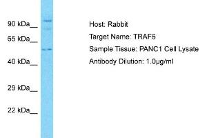 Host: Rabbit Target Name: TRAF6 Sample Type: PANC1 Whole Cell lysates Antibody Dilution: 3. (TRAF6 抗体  (C-Term))