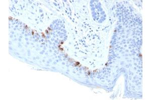 Formalin-fixed, paraffin-embedded human Skin stained with TYRP1-Monospecific Mouse Monoclonal Antibody (TYRP1/3283). (Tyrosinase-Related Protein 1 抗体  (AA 257-377))