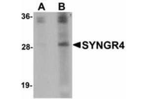 Image no. 1 for anti-Synaptogyrin 4 (SYNGR4) (N-Term) antibody (ABIN478102) (SYNGR4 抗体  (N-Term))