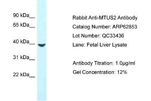 Western Blotting (WB) image for anti-Microtubule-associated Tumor Suppressor Candidate 2 (MTUS2) (C-Term) antibody (ABIN2789268) (CAZIP 抗体  (C-Term))