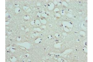 Immunohistochemistry (IHC) image for anti-Solute Carrier Family 1 (High Affinity Aspartate/glutamate Transporter), Member 6 (SLC1A6) (AA 149-271) antibody (ABIN7152238)