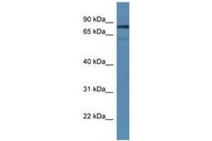 Image no. 1 for anti-Tyrosyl-DNA Phosphodiesterase 1 (TDP1) (AA 350-399) antibody (ABIN6746494)