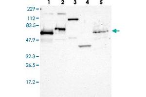 Western blot analysis of Lane 1: RT-4, Lane 2: U-251 MG, Lane 3: Human Plasma, Lane 4: Liver, Lane 5: Tonsil with ETV3 polyclonal antibody  at 1:250-1:500 dilution. (ETV3 抗体)