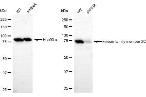 Western blotting analysis using kinesin family member 2C antibody (ABIN7799206). (Recombinant KIF2C 抗体)