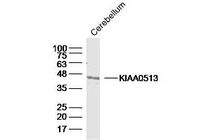Mouse cerebellum lysates probed with KIAA0513 Polyclonal Antibody, Unconjugated  at 1:300 dilution and 4˚C overnight incubation. (KIAA0513 抗体  (AA 21-100))