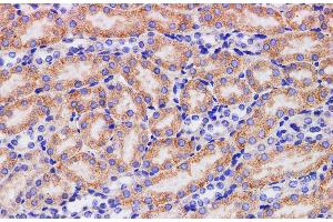 Immunohistochemistry of paraffin-embedded Mouse kidney using HPGD Polyclonal Antibody at dilution of 1:200 (HPGD 抗体)