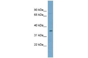 WB Suggested Anti-SLC39A2 Antibody Titration:  0. (ZIP2 抗体  (N-Term))