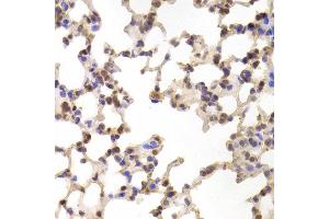 Immunohistochemistry of paraffin-embedded Mouse lung using ALOX15B antibody at dilution of 1:100 (x400 lens). (ALOX15B 抗体)