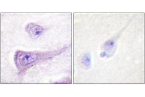 Immunohistochemistry analysis of paraffin-embedded human brain, using WASP (Phospho-Tyr290) Antibody. (WASP 抗体  (pTyr290))
