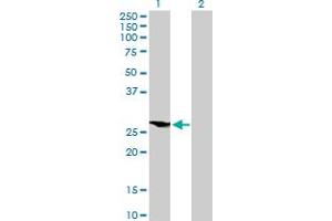 Western Blot analysis of HOXB9 expression in transfected 293T cell line by HOXB9 MaxPab polyclonal antibody. (HOXB9 抗体  (AA 1-250))