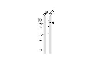Western blot analysis of lysates from Hela, 293T cell line (from left to right), using SNX1 Antibody at 1:1000 at each lane. (Sorting Nexin 1 抗体  (C-Term))