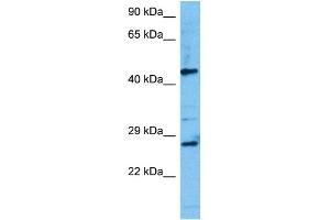 Host:  Mouse  Target Name:  TCF7  Sample Tissue:  Mouse Testis  Antibody Dilution:  1ug/ml (TCF7 抗体  (N-Term))
