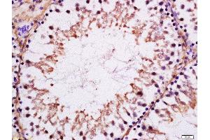 Formalin-fixed and paraffin embedded rat testis labeled with Anti-MAK Polyclonal Antibody, Unconjugated  at 1:200 followed by conjugation to the secondary antibody and DAB staining. (MAK 抗体  (AA 101-200))