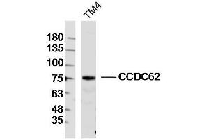 TM4 lysates probed with CCDC62 Polyclonal Antibody, Unconjugated  at 1:300 dilution and 4˚C overnight incubation. (CCDC62 抗体  (AA 1-100))