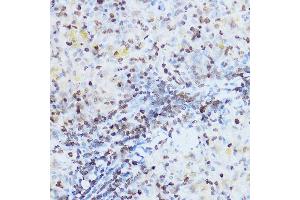 Immunohistochemistry of paraffin-embedded rat spleen using OGT Rabbit pAb (ABIN3022707, ABIN3022708, ABIN3022709 and ABIN6219152) at dilution of 1:100 (40x lens). (OGT 抗体  (AA 857-1036))