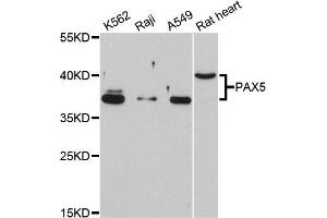Western blot analysis of extracts of various cell lines, using PAX5 antibody (ABIN5998458) at 1/1000 dilution. (PAX5 抗体)