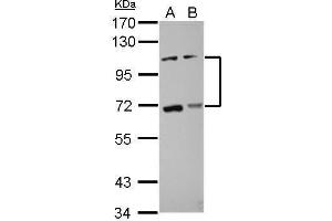 WB Image Sample (30 ug of whole cell lysate) A: HCT116 B: MCF-7 7. (ADAMTS5 抗体  (C-Term))