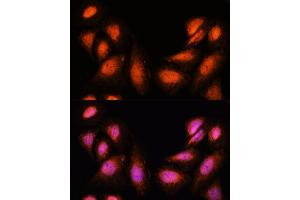 Immunofluorescence analysis of U-2 OS cells using SUPT6H antibody (ABIN7270645) at dilution of 1:100. (Spt6 抗体  (AA 1500-1726))
