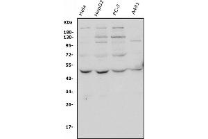 Western blot analysis of ATG4A using anti-ATG4A antibody (ABIN7603108).