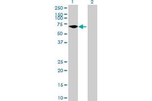 Western Blot analysis of FLJ38451 expression in transfected 293T cell line by FLJ38451 MaxPab polyclonal antibody.