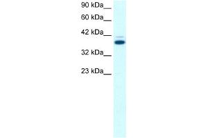 WB Suggested Anti-GABPB2 Antibody Titration:  0.