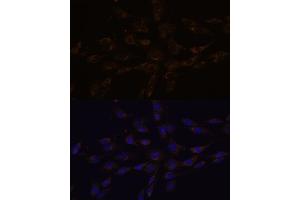 Immunofluorescence analysis of C6 cells using RGS4 antibody (ABIN7269898) at dilution of 1:100. (RGS4 抗体  (AA 1-100))
