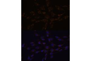 Immunofluorescence analysis of C6 cells using RGS4 antibody (ABIN7269898) at dilution of 1:100. (RGS4 抗体  (AA 1-100))