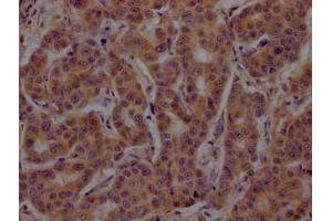 Immunohistochemistry (IHC) image for anti-Activating Transcription Factor 4 (Tax-Responsive Enhancer Element B67) (ATF4) (AA 20-200) antibody (ABIN7148794)
