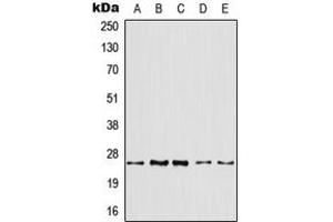 Western blot analysis of ARF4 expression in HeLa (A), HepG2 (B), mouse liver (C), mouse kidney (D), rat kidney (E) whole cell lysates.