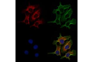ABIN6258659 and ABIN6274961 staining Hela cells by IF/ICC. (CA5A 抗体  (Internal Region))