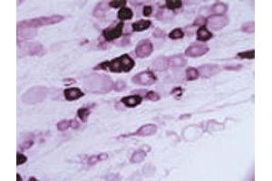 Immunohistochemical staining of Trpv2 in rat trigeminal ganglion using Trpv2 polyclonal antibody . (TRPV2 抗体  (AA 744-761))