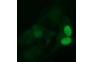 Image no. 2 for anti-Ubiquitin-Conjugating Enzyme E2S (UBE2S) antibody (ABIN1501646) (UBE2S 抗体)