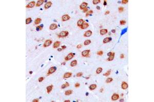 Immunohistochemical analysis of Kir3. (KCNJ9 抗体  (Center))