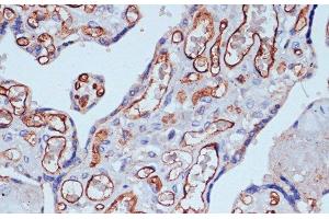 Immunohistochemistry of paraffin-embedded Human placenta using CD34 Polyclonal Antibody at dilution of 1:100 (40x lens). (CD34 抗体)