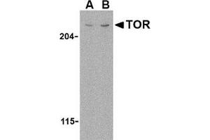 Western blot analysis of TOR in L1210 cell lysate with this product at (A) 1 and (B) 2 μg/ml. (MTOR 抗体  (N-Term))