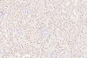 Immunohistochemistry analysis of paraffin-embedded rat kidney using,TORC1 (ABIN7073590) at dilution of 1: 800 (CRTC1 抗体)