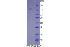 SDS-PAGE analysis of Mouse Thrombin Protein. (SERPINC1 蛋白)