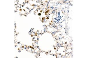 Immunohistochemistry of paraffin-embedded Rat lung using CD63 antibody (ABIN7266210) at dilution of 1:200 (40x lens). (CD63 抗体)