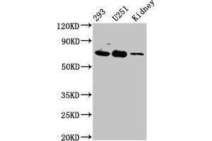 Western Blot Positive WB detected in: 293 whole cell lysate, U251 whole cell lysate, Rat kidney tissue All lanes: EOMES antibody at 4. (EOMES 抗体  (AA 562-676))
