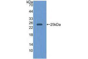 Western blot analysis of recombinant Human EBI3. (EBI3 抗体)