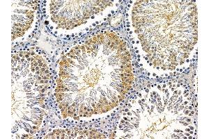 ABIN7095752 and ABIN7099814 at 1/100 staining rat testis tissue by IHC-P.