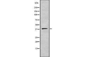 Western blot analysis of ELAV2/4 using COLO205 whole cell lysates (ELAV2/4 抗体)