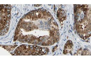 ABIN6273576 at 1/100 staining Human prostate tissue by IHC-P. (VSIG2 抗体  (Internal Region))