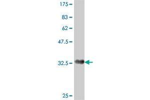 Western Blot detection against Immunogen (36. (ACADVL 抗体  (AA 345-434))