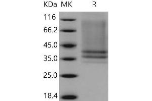 Western Blotting (WB) image for Interleukin 7 Receptor (IL7R) protein (His tag) (ABIN7320411) (IL7R Protein (His tag))