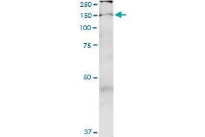 Immunoprecipitation (IP) image for anti-TBC1 (Tre-2/USP6, BUB2, Cdc16) Domain Family, Member 1 (TBC1D1) (AA 1-1168) antibody (ABIN949094)