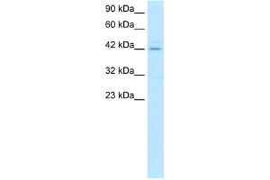 WB Suggested Anti-HOXA10 Antibody Titration:  0. (HOXA10 抗体  (N-Term))
